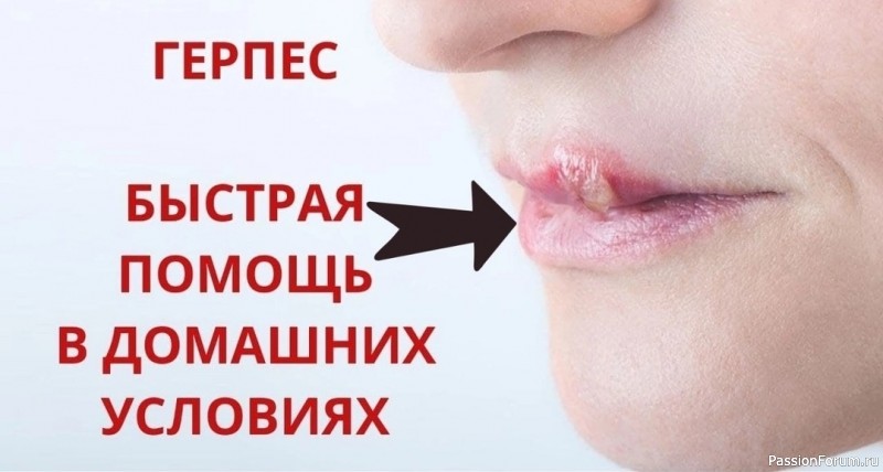 Лечим герпес народными средствами