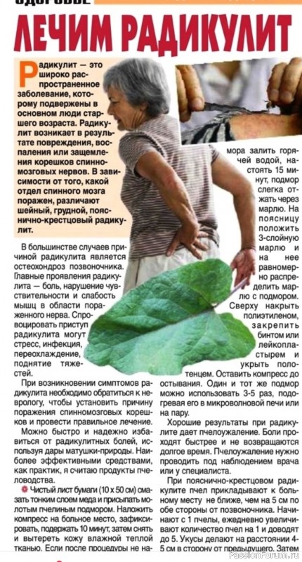 Лечение радикулита народными средствами