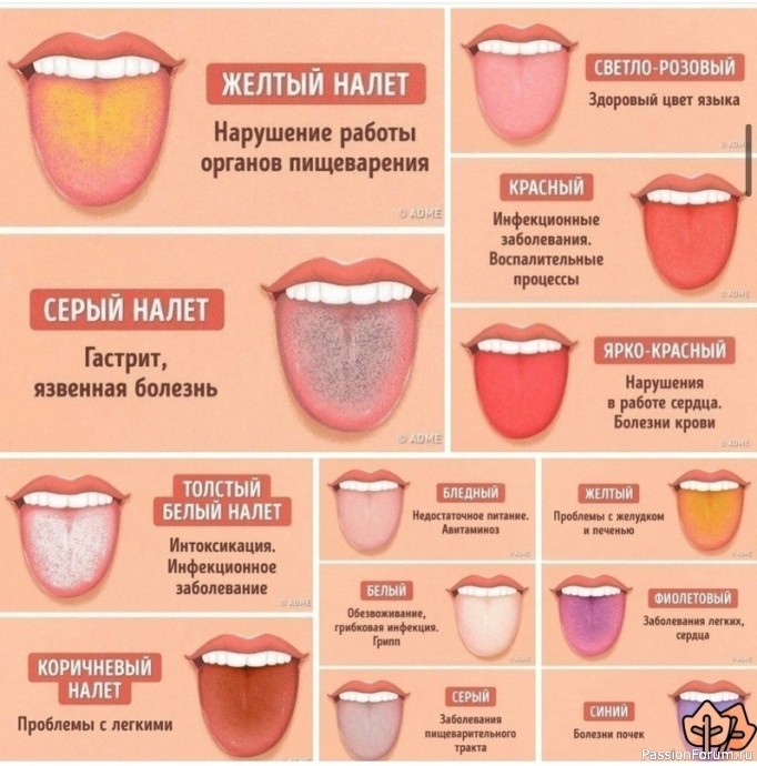 О чем может рассказать цвет языка и налет на нем