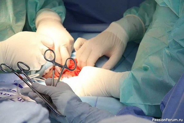 Как небольшие камни в почках могут стать большой проблемой